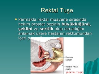 Rektal Tuşe Parmakla rektal muayene sırasında hekim prostat bezinin  büyüklüğünü ,  şeklini  ve  sertlik  olup olmadığını anlamak üzere hastanın rektumundan içeri parmağını sokar 