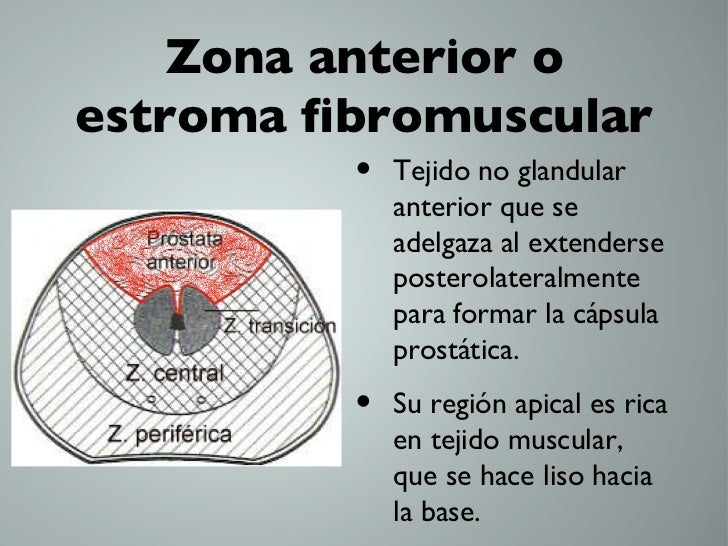 Zonas de la prostata ecografia