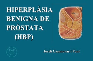 Jordi Casanovas i Font HIPERPLÀSIA BENIGNA DE PRÒSTATA  (HBP) 