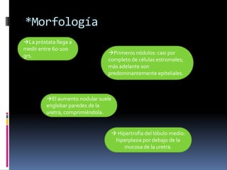 *Morfología
La próstata llega a
medir entre 60-100
grs.

Primeros nódulos: casi por
completo de células estromales;
más adelante son
predominantemente epiteliales.

El aumento nodular suele
englobar paredes de la
uretra, comprimiéndola.

 Hipertrofia del lóbulo medio:
hiperplasia por debajo de la
mucosa de la uretra.

 
