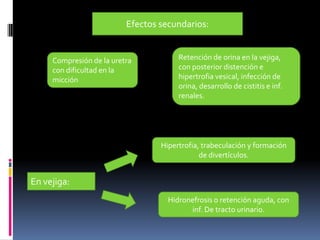 Efectos secundarios:

Compresión de la uretra
con dificultad en la
micción

Retención de orina en la vejiga,
con posterior distención e
hipertrofia vesical, infección de
orina, desarrollo de cistitis e inf.
renales.

Hipertrofia, trabeculación y formación
de divertículos.

En vejiga:
Hidronefrosis o retención aguda, con
inf. De tracto urinario.

 