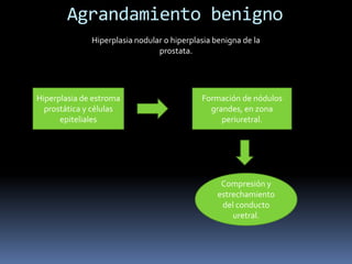 Agrandamiento benigno
Hiperplasia nodular o hiperplasia benigna de la
prostata.

Hiperplasia de estroma
prostática y células
epiteliales

Formación de nódulos
grandes, en zona
periuretral.

Compresión y
estrechamiento
del conducto
uretral.

 