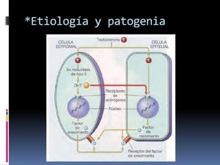 *Etiología y patogenia

 