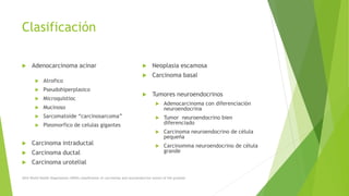 Clasificación
 Adenocarcinoma acinar
 Atrofico
 Pseudohiperplasico
 Microquistioc
 Mucinoso
 Sarcomatoide “carcinosarcoma”
 Pleomorfico de celulas gigantes
 Carcinoma intraductal
 Carcinoma ductal
 Carcinoma urotelial
 Neoplasia escamosa
 Carcinoma basal
 Tumores neuroendocrinos
 Adenocarcinoma con diferenciación
neuroendocrina
 Tumor neuroendocrino bien
diferenciado
 Carcinoma neuroendocrino de célula
pequeña
 Carcinomma neuroendocrino de célula
grande
2016 World Health Organization (WHO) classiﬁcation of carcinomas and neuroendocrine tumors of the prostate
 