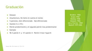 Graduación
 Gleason
 Arquitectura, No tiene en cuenta el núcleo
 5 patrones, bien diferenciado – Mal diferenciado
 Usando 4 x o 10 x
 Patrón predominante y el segundo patrón mas predominante
 Ejemplo
 96 % patrón 4 y 4 % patrón 4: Patrón 4 mas 4 igual 8
(Gleason 1966, 1992; Gleason et al. 1974, 1977
Broders 1926
Evans 1942
Shelley 1958
Gleason 1966
Utz y Farrow 1969
Mostofi 1975 OMS
 