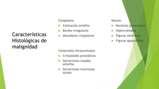 Adenocarcinom
a acinar:
Características
Histológicas de
malignidad.cop
ia
Citoplasma
 Coloración amófila
 Bordes irregulares
 Abundante citoplasma
Contenidos intraluminales
 Cristaloides prostáticos
 Secreciones rosadas
amorfas
 Secreciones mucinosas
azules
Núcleo
 Nucleolo prominente
 Hipercromasia
 Figuras mitóticas
 Figuras apoptóticas
 