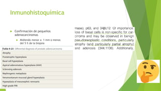 Inmunohistoquímica
 Confirmación de pequeños
adenocarcinomas
 Midiendo menor a 1 mm o menos
del 5 % de la biopsia
 