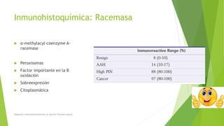 Inmunohistoquímica: Racemasa
 α-methylacyl-coenzyme A-
racemase
 Peroxisomas
 Factor importante en la B
oxidación
 Sobreexpresión
 Citoplasmática
Diagnostic Immunohistochemistry of Specific Prostate Lesions
 