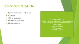 Carcinoma intraductal
 Neoplasia intraacinar o intraductal
 Alto grado
 17 % de las biopsias
 Localización: periférico
 Gleason mayor de 4
Criterios diagnósticos
Células malignas que cubren grandes acinos y
conductos prostaticos con preservación de
celulas basales:
-Patrón cribiforme
-Atipia celular
-Comedonecrosis
 