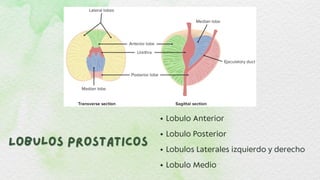 Lobulos Prostaticos
Lobulos Prostaticos
Lobulo Anterior
Lobulo Posterior
Lobulos Laterales izquierdo y derecho
Lobulo Medio
 