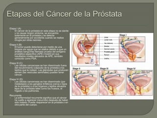Etapa I (A)
   El cáncer de la próstata en esta etapa no se siente
    y no causa ningún síntoma, se encuentra
    solamente en la próstata y se detecta
    generalmente por accidente cuando se realiza
    cirugía por otras razones.
Etapa II (B)
   El tumor puede detectarse por medio de una
    biopsia por aguja que se realice debido a que un
    análisis sanguíneo llamado prueba del antígeno
    prostático específico (APE) mostró en sus
    resultados niveles elevados de APE, también
    conocido como PSA.
Etapa III (C)
   Las células cancerosas se han diseminado fuera
    del recubrimiento (cápsula) de la próstata a los
    tejidos que la rodean. Las glándulas que producen
    semen (las vesículas seminales) pueden tener
    cáncer.
Etapa IV (D)
   Las células cancerosas se han diseminado (por
    metástasis) a los ganglios linfáticos (cerca o lejos
    de la próstata) o a los órganos y tejidos situados
    lejos de la próstata tales como los huesos, el
    hígado o los pulmones.
Recurrente
   La enfermedad recurrente significa que el cáncer
    ha vuelto a aparecer (recurrido) después de haber
    sido tratado. Puede reaparecer en la próstata o en
    otra parte del cuerpo.
 