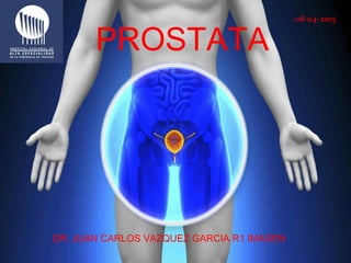 PROSTATA
DR. JUAN CARLOS VAZQUEZ GARCIA R1 IMAGEN
08-04-2015
 
