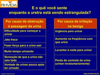 E o quê você sente  enquanto a uretra está sendo estrangulada? Vontade de urinar pouco após ter urinado Sensação de que a urina não saiu toda Muito tempo urinando Fazer força para a urina sair Jato fraco Dificuldade para começar a urinar Por causa da obstrução à passagem da urina Perda do controle da urina (urinar involuntariamente) Levantar à noite para urinar Aumento na freqüência com que urina Urgência para urinar Por causa da irritação  na bexiga 