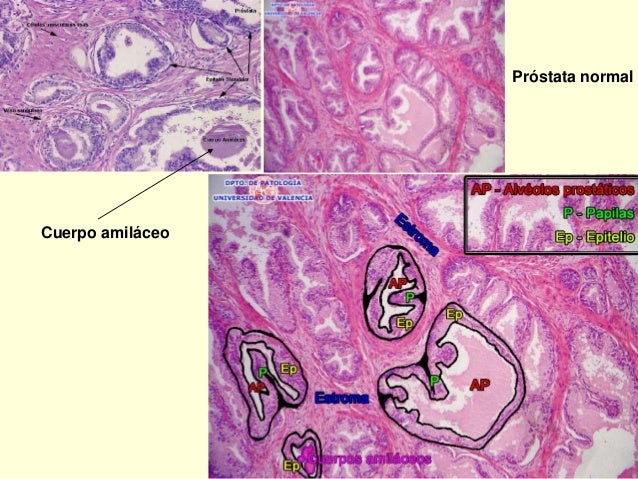 Próstata y testículo