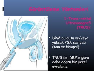 Görüntüleme Yöntemleri
1-Trans-rektal
Ultrasonografi
(TRUS):
 DRM bulgusu ve/veya

yüksek PSA seviyesi
(tanı ve biyopsi)

 TRUS ile, DRM’e göre

daha doğru bir yerel
evreleme

 