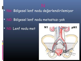 N

 Nx: Bölgesel lenf nodu değerlendirilemiyor
 N0: Bölgesel lenf nodu metastazı yok
 N1: Lenf nodu met

 