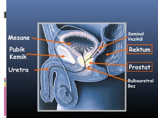 Mesane

Seminal
Vezikül

Pubik
Kemik

Rektum

Uretra

Prostat
Bulbouretral
Bez

 