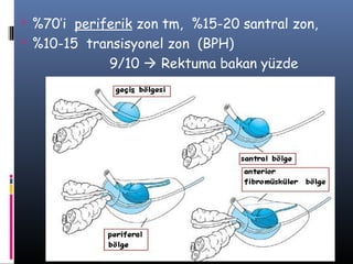 %70’i periferik zon tm, %15-20 santral zon,
 %10-15 transisyonel zon (BPH)

9/10  Rektuma bakan yüzde

 