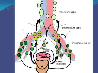Prostrate Node Surgical Anatomy of Prostate | PPTX