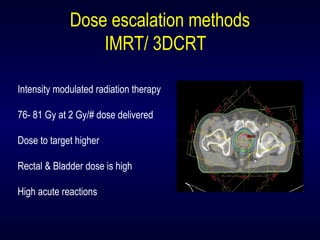 Intensity modulated radiation therapy
76- 81 Gy at 2 Gy/# dose delivered
Dose to target higher
Rectal & Bladder dose is high
High acute reactions
Dose escalation methods
IMRT/ 3DCRT
 