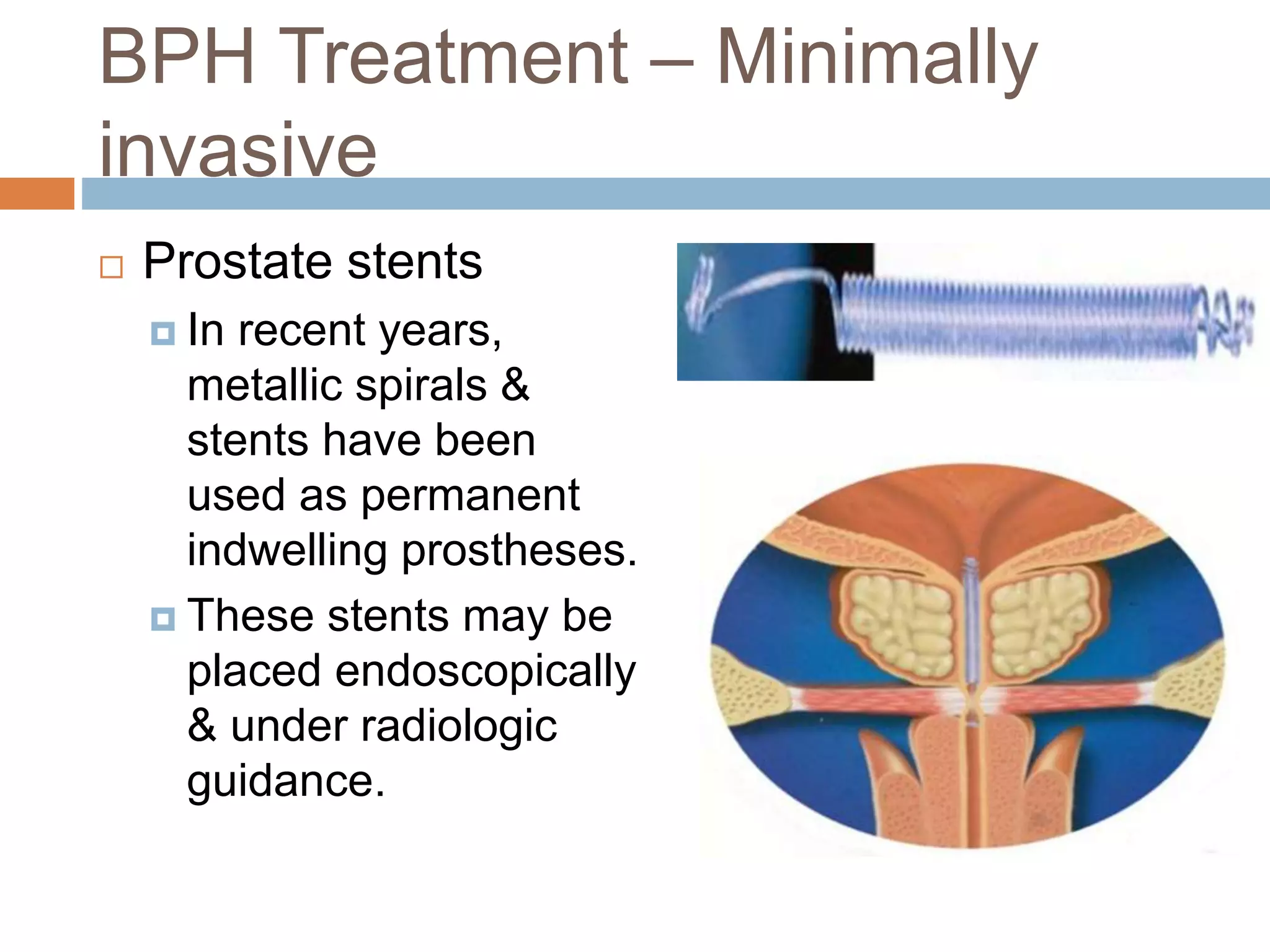 BPH Treatment – Minimally
invasive
 Prostate stents
 In recent years,
metallic spirals &
stents have been
used as permanent
indwelling prostheses.
 These stents may be
placed endoscopically
& under radiologic
guidance.
 