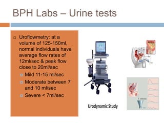Flow Bph Prostate | PPTX