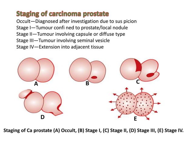 PROSTATE CANCER ANATOMY AND PHYSIOLOGY visual data 8