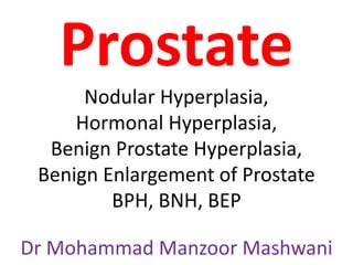 Prostate
Nodular Hyperplasia,
Hormonal Hyperplasia,
Benign Prostate Hyperplasia,
Benign Enlargement of Prostate
BPH, BNH, BEP
Dr Mohammad Manzoor Mashwani
 