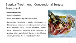 Surgical Treatment : Conventional Surgical
Treatment
Open Prostatectomy
• Not done routinely
• When prostate too large for TURP (>100mL)
• Concomitant conditions - bladder diverticulum or
bladder stone present, recurrent or persistent urinary
tract infections, acute urinary distention, bladder
outlet obstructions, recurrent gross hematuria of
prostate origin, pathological changes in the bladder,
ureters, or kidneys due to prostate obstruction
35
 