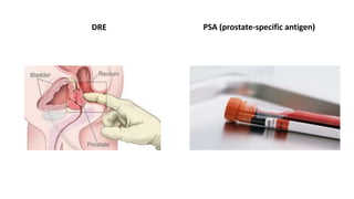 DRE PSA (prostate-specific antigen)
 