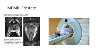 MPMRI Prostate
 