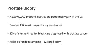 Prostate Biopsy
• > 1,20,00,000 prostate biopsies are performed yearly in the US
• Elevated PSA most frequently triggers biopsy
• 30% of men referred for biopsy are diagnosed with prostate cancer
• Relies on random sampling – 12 core biopsy
 