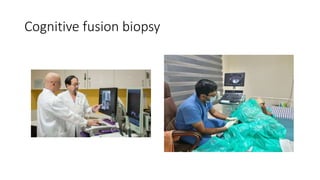 Cognitive fusion biopsy
 