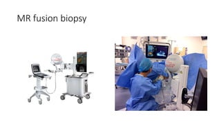 MR fusion biopsy
 