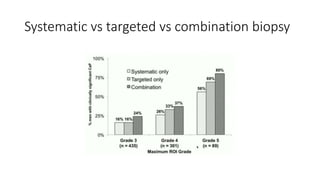 Systematic vs targeted vs combination biopsy
 
