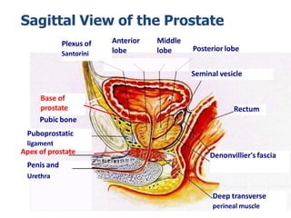 Lobes Of Prostate Gland Diagram