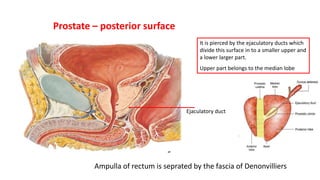 Prostate – posterior surface
It is pierced by the ejaculatory ducts which
divide this surface in to a smaller upper and
a lower larger part.
Upper part belongs to the median lobe
Ejaculatory duct
Ampulla of rectum is seprated by the fascia of Denonvilliers
 