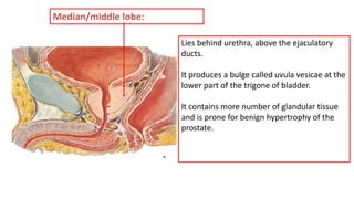 Lies behind urethra, above the ejaculatory
ducts.
It produces a bulge called uvula vesicae at the
lower part of the trigone of bladder.
It contains more number of glandular tissue
and is prone for benign hypertrophy of the
prostate.
Median/middle lobe:
 