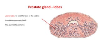Prostate gland - lobes
Lateral lobes: lie on either side of the urethra
It contains numerous glands
May give rise to adenoma
 