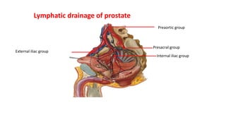 Lymphatic drainage of prostate
External iliac group
Preaortic group
Presacral group
Internal iliac group
 