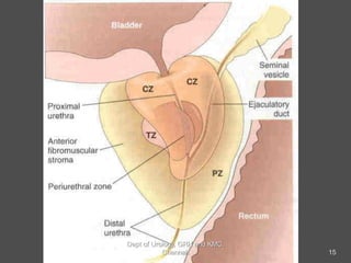 15
Dept of Urology, GRH and KMC,
Chennai.
 