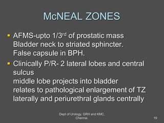 McNEAL ZONES
 AFMS-upto 1/3rd of prostatic mass
Bladder neck to striated sphincter.
False capsule in BPH.
 Clinically P/R- 2 lateral lobes and central
sulcus
middle lobe projects into bladder
relates to pathological enlargement of TZ
laterally and periurethral glands centrally
19
Dept of Urology, GRH and KMC,
Chennai.
 