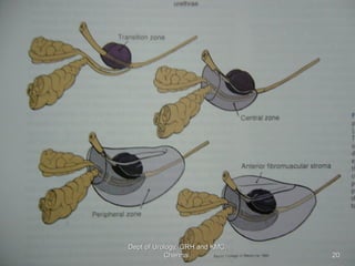 20
Dept of Urology, GRH and KMC,
Chennai.
 