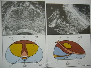 21
Dept of Urology, GRH and KMC,
Chennai.
 