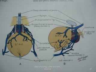 27
Dept of Urology, GRH and KMC,
Chennai.
 