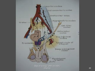 46
Dept of Urology, GRH and KMC,
Chennai.
 