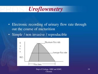 Uroflowmetry
• Electronic recording of urinary flow rate through
out the course of micturition
• Simple / non invasive / reproducible
19
Dept of Urology, GRH and KMC,
Chennai.
 