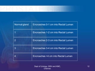 Normal gland Encroaches 0-1 cm into Rectal Lumen
1 Encroaches 1-2 cm into Rectal Lumen
2 Encroaches 2-3 cm into Rectal Lum...