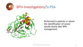 Performed in patients in whom
the identification of cancer
would clearly alter BPH
management.
BPH-Investigations/Sr.PSA
1...