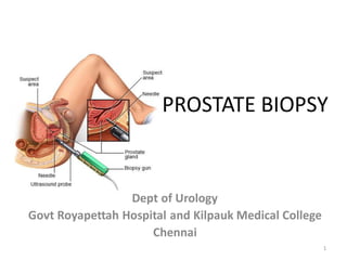 PROSTATE BIOPSY
Dept of Urology
Govt Royapettah Hospital and Kilpauk Medical College
Chennai
1
 